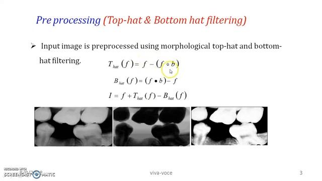 Top Hat and Bottom Hat Filtering смотреть онлайн