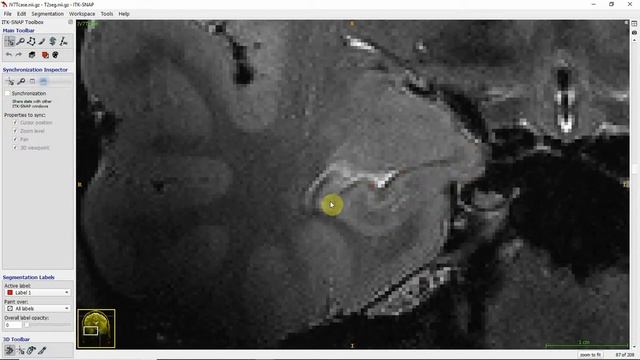 Overview of the hippocampus смотреть онлайн