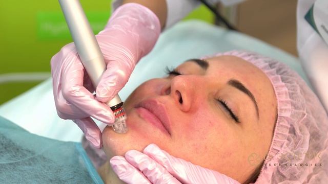 HydraPeel Plus