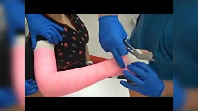 Полимерный бинт INTRARICH смотреть онлайн