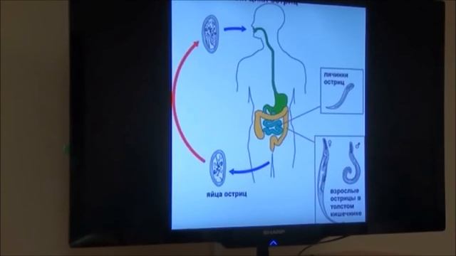 2Паразиты Энтеробиоз острицы смотреть онлайн