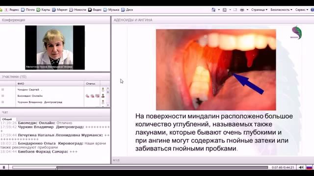 ***Аденоиды и Миндалины***|***Adenoidy i Mindaliny*** смотреть онлайн