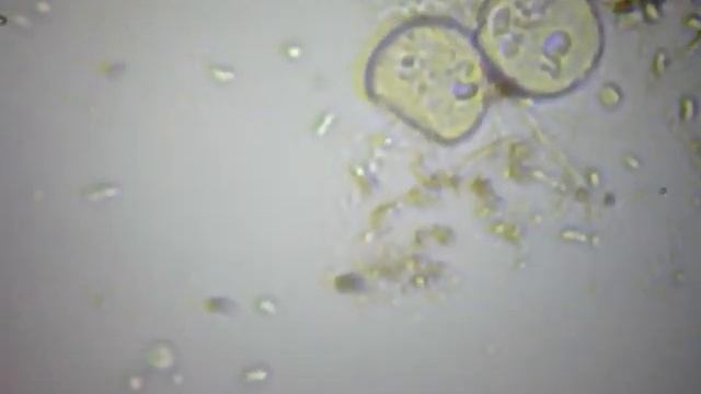 Жизнь в капле аквариумной воды смотреть онлайн