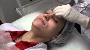 Биоревитализация - как делать идеальные папуллы