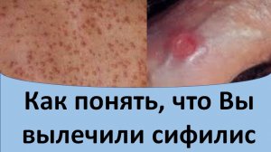 Как понять, что Вы вылечили сифилис.