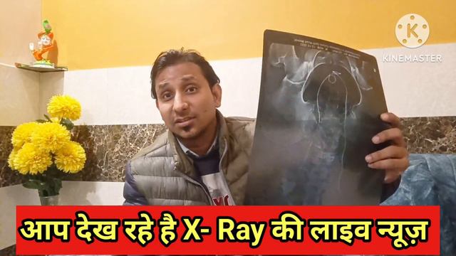 16 mm Kidney Stone Claim Pass of Rs. 1 Lakh | 16 mm की पथरी का क्लेम हुआ पास | @InsuranceJaruriHai смотреть онлайн