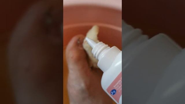 Снятие прилипшей повязки с раны смотреть онлайн
