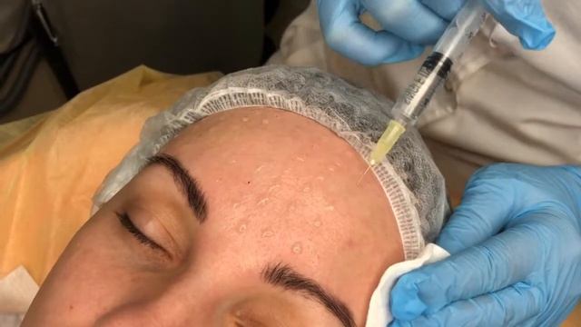 OLA - сеть салонов красоты №1 Мезопил. Врач-косметолог Н.Н.Голощапова