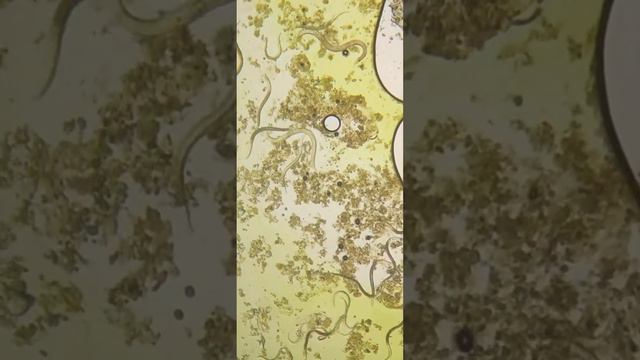 🦠🧴Как действует жидкое мыло на глистов/ Глисты Острицы смотреть онлайн