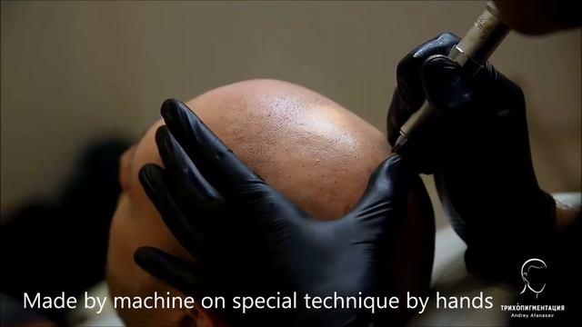 ENG Scalp Micropigmentation by Andrey Afnasev, Moscow. Sergey's story смотреть онлайн