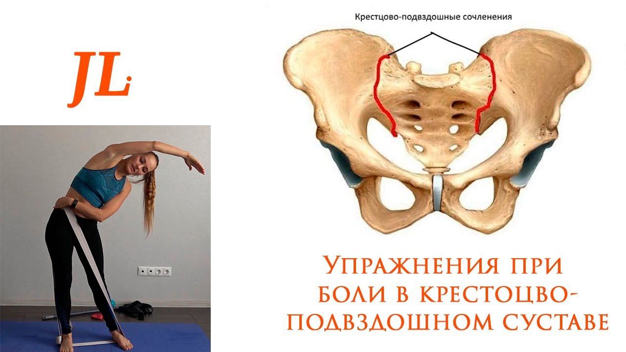 Упражнения при боли в крестцово-подвздошном суставе. Дисфункция КПС. смотреть онлайн