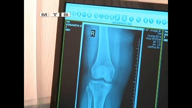 Цифровой рентген в МЦ "Адастра" смотреть онлайн