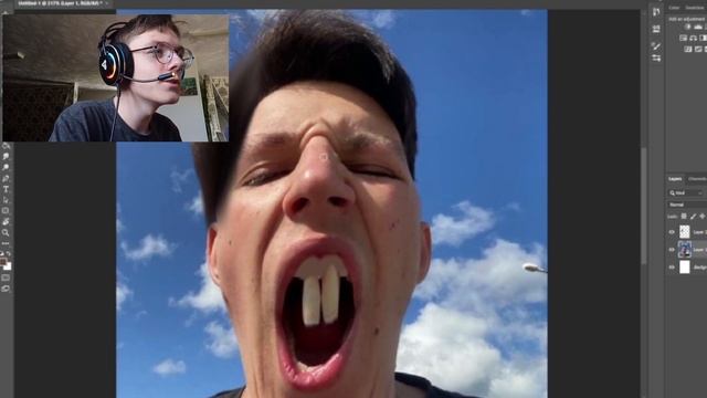 Как выровнить зубы в домашних условиях? ( Гайд от мазелова ) смотреть онлайн