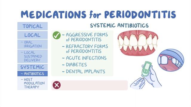 Pharmacologic adjuncts to conventional periodontal therapy.mp4 смотреть онлайн