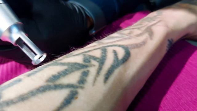 Осветление татуировки под перекрытие Калининград Magnum Tattoo смотреть онлайн