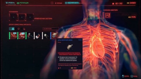 Все самое нужное о кибер имплантах в Cyberpunk 2077