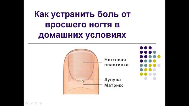 Вросший ноготь. Как устранить боль от вросшего ногтя дома смотреть онлайн