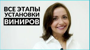 Как устанавливают виниры на зубы? Все этапы установки виниров. InSmile