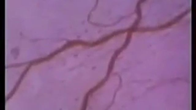 Анатомия человека Строение и функции эритроцитов смотреть онлайн