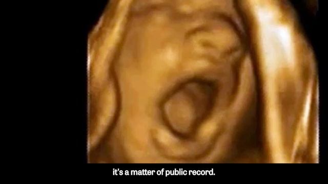 Pitt's Fetal Experimentation is the Next Gosnell - Harvesting Organs from Live Babies смотреть онлайн