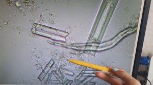 Общий анализ мочи с нуля с микроскопией