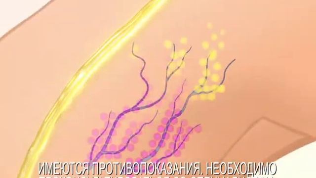 Troxevasin 20sec v2 смотреть онлайн