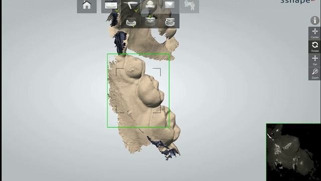 Intraoral Scanner- Changing Orthodontic Practice смотреть онлайн