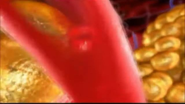 LPG Волгоград.wmv смотреть онлайн