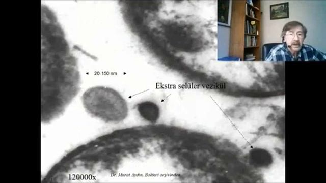 PORPHYROMONAS GİNGİVALİS смотреть онлайн