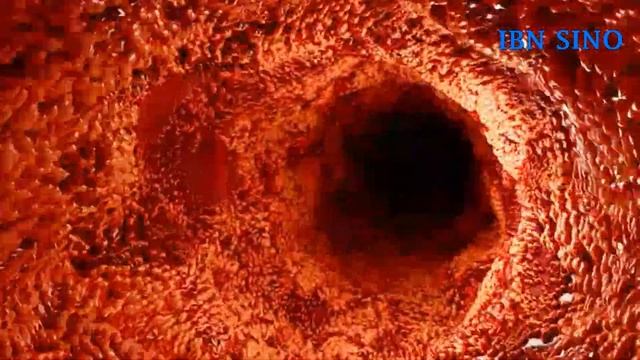 БУЙРАК ВА СИЙДИК ЙЎЛИ ШАМОЛЛАШИНИ УЙ ШАРОИТИДА ДАВОЛАЙМИЗ. ХАЛҚ ТАБОБАТИ смотреть онлайн