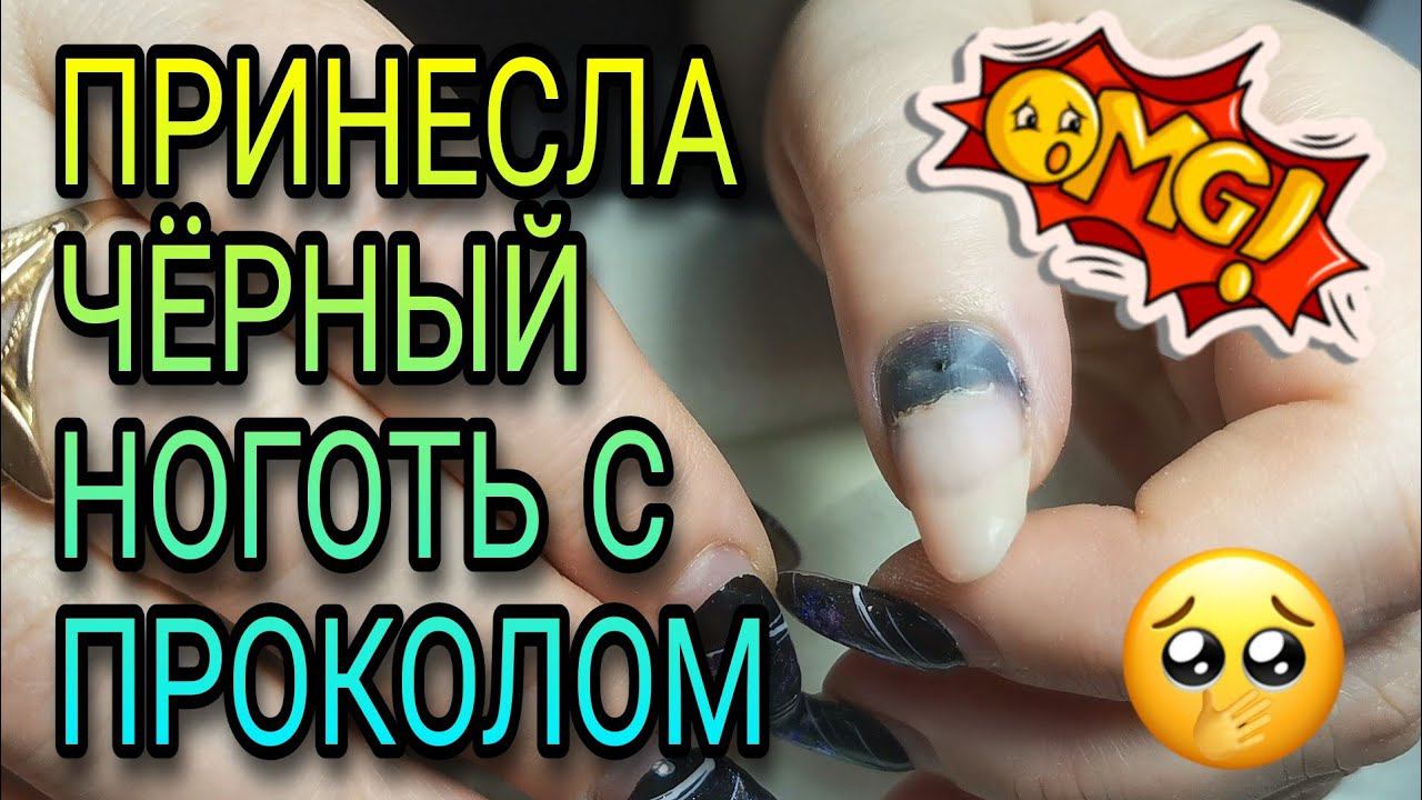 Чёрный ноготь. Носка ногтей в 1,5 месяца ЧРЕВАТА ПОСЛЕДСТВИЯМИ!!! Почему нельзя перенашивать. смотреть онлайн