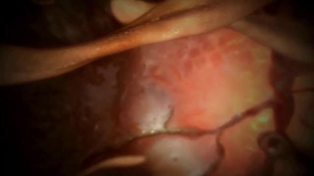 РЕАЛЬНЫЕ ВАМПИРЫ смотреть онлайн