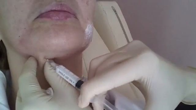 Липолитики смотреть онлайн