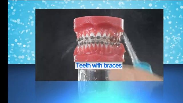 Aquapick Oral Irrigator AQ 300 Before & After смотреть онлайн