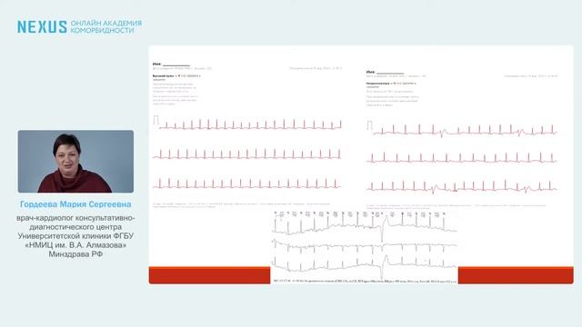 Современная электрокардиология: новые ЭКГ-маркеры, регистрация ЭКГ, применение ИИ в анализе ЭКГ