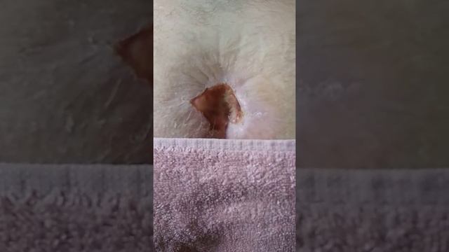 Лечение пролежня Цельгелем смотреть онлайн