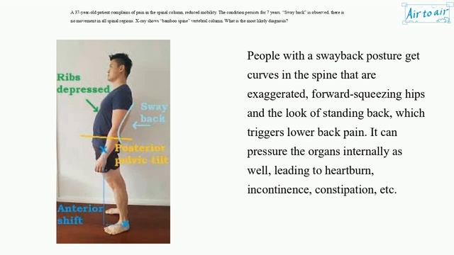 [ Krok 2 Medicine ] Year: 2019 - 092 (Ministry of Public Health of Ukraine) смотреть онлайн