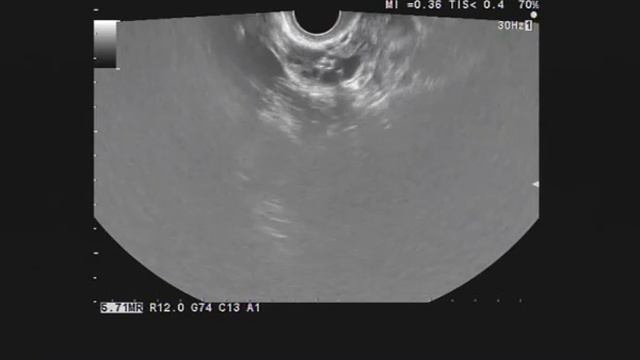 БТЯ664 смотреть онлайн
