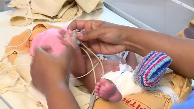 How to administer oxygen to a newborn baby? смотреть онлайн