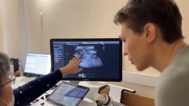 ВЛОГ: РЕЗУЛЬТАТЫ УЗИ, СТРИЖКА НЕ ПОЛУЧИЛАСЬ. ОДИН ДЕНЬ СЕМЬИ С МАЛЫШОМ С СИНДРОМОМ ДАУНА. смотреть онлайн