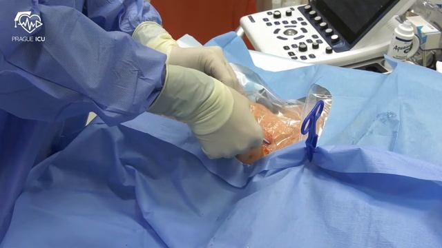 Central Venous Catheter Insertion (Internal Jugular Vein)