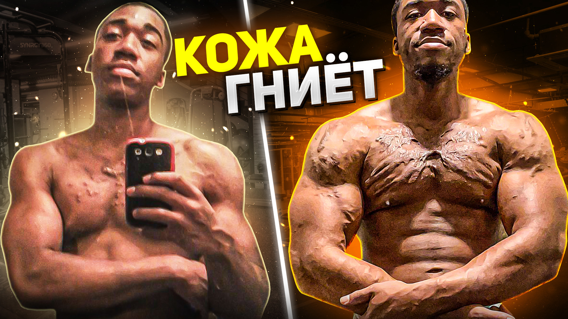 КЕЛОИДНЫЕ ПРИЩИ ОТ ХИМИИ. ПОСЛЕДСТВИЯ, КАК УБРАТЬ смотреть онлайн