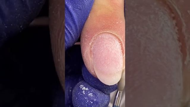 #shorts Как удалить заусенцы на пальце #маникюр #аппаратныйманикюр #заусенцы #nail смотреть онлайн