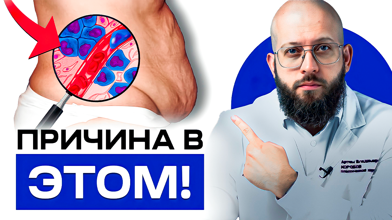 Почему не уходит живот после родов смотреть онлайн