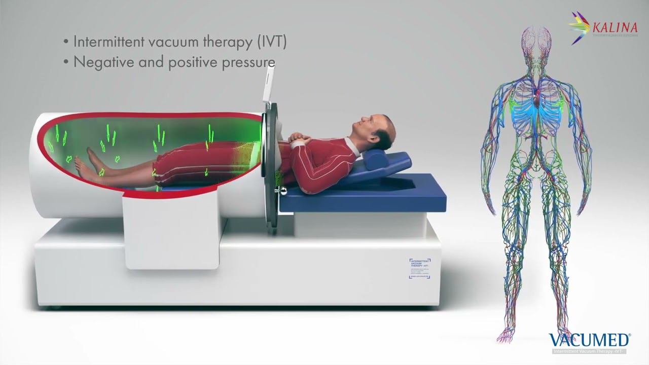 Vacumed - аппарат интервальной вакуумной терапии смотреть онлайн