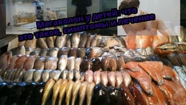 Мегаколон у детей: что это такое симптомы и лечение