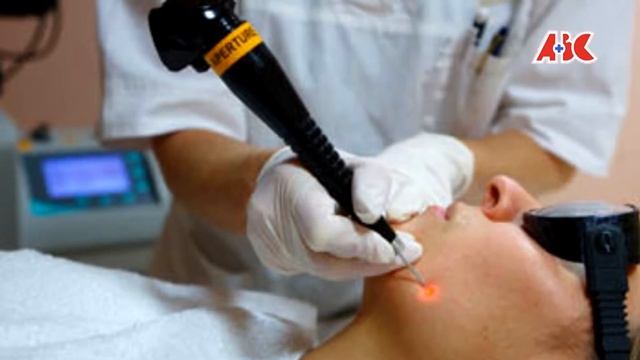 Удаление родинок на лице. смотреть онлайн