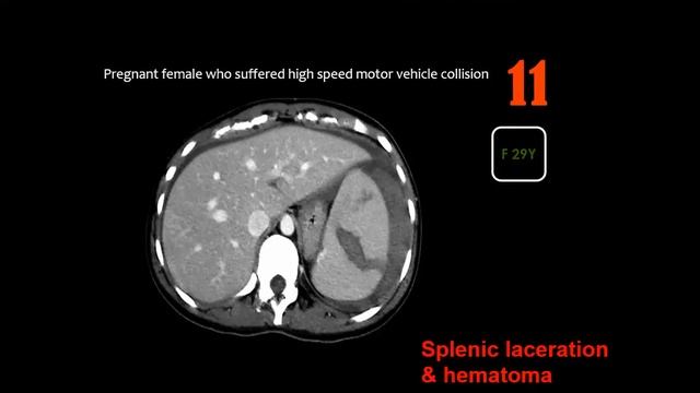 GIT quiz cases by Dr Sherif Sameh MD смотреть онлайн