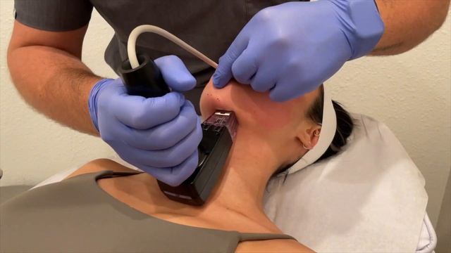 MORPHEUS 8 Procedure Experience