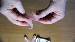 Нейлоновые зубные протезы-"плюсы"и "минусы"